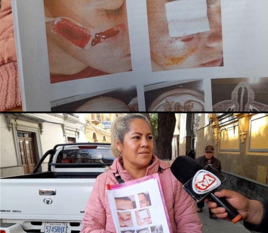 Denuncian brutal agresión en colegio La Salle Convenio: estudiante terminó con fracturas y cortes en el rostro