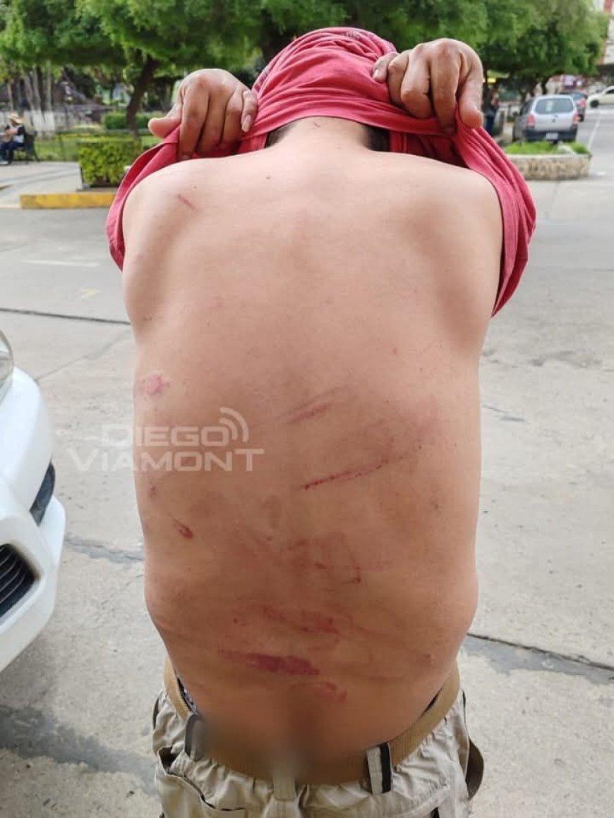 Hombre denuncia agresión física por parte de su expareja en Cochabamba